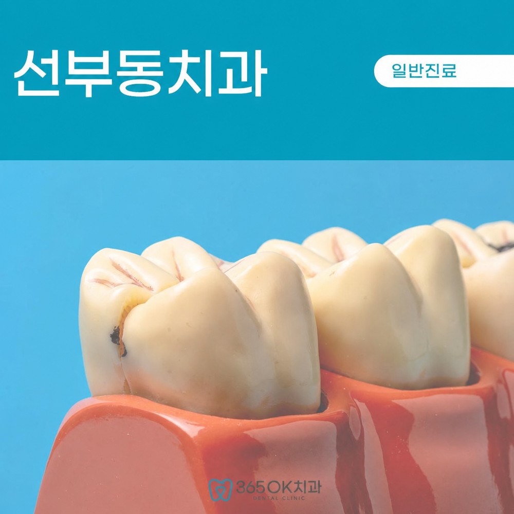 선부동치과 찬물 마실 때 반복되는 치아 시림 원인 확인 초기 점검 필요 사항
