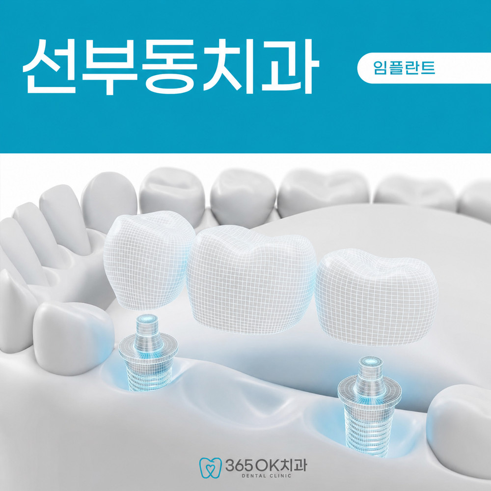 선부동치과 치아 상실 후 씹기 발음 불편과 임플란트 상담 시작 판단 기준