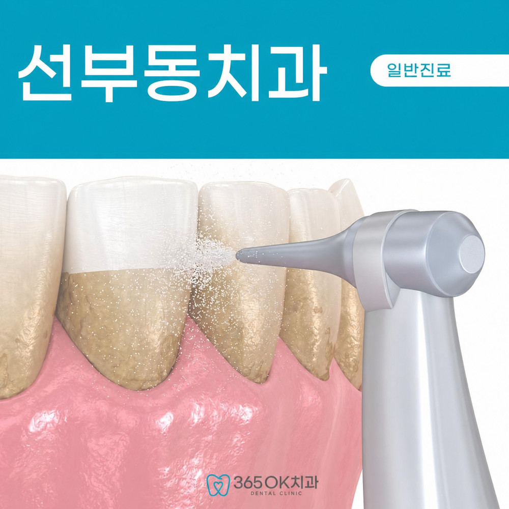 선부동치과 스케일링 시기 양치 중 잇몸 출혈과 입안 텁텁함 판단 기준 확인