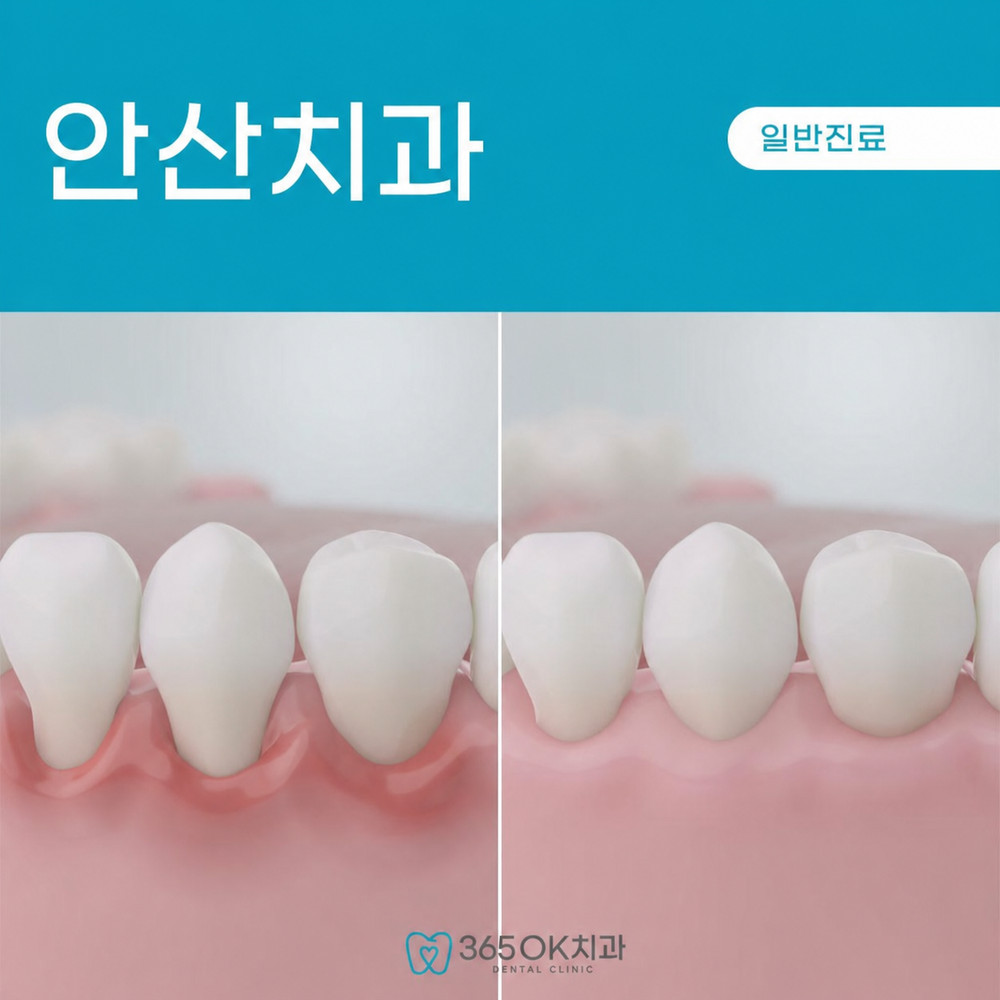 안산치과 잇몸치료 필요 순간 붓기 출혈 반복과 식사 불편 조기 원인 확인