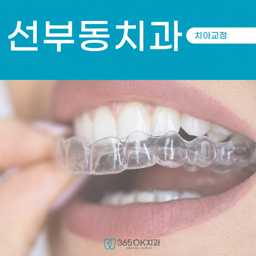 선부동치과 투명교정 추천 전 고르지 않은 치아 배열 고민과 외관 부담 확인