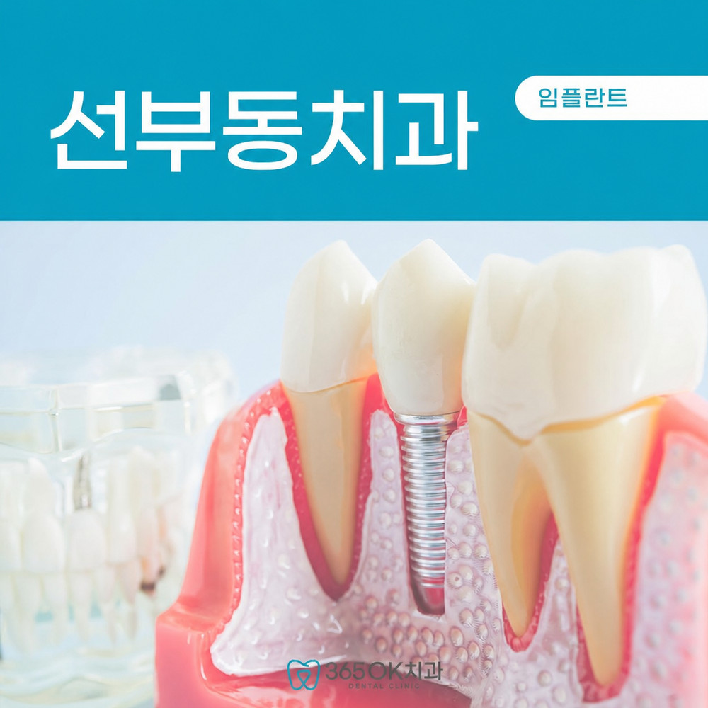 선부동치과 임플란트 가능 여부 고민과 잇몸뼈 부족 상태별 상담 필요성