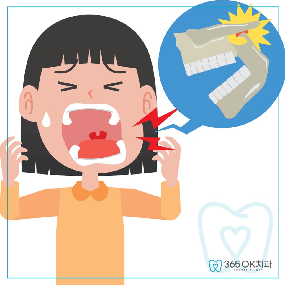 선부동치과 턱관절 디스크 이탈과 근육 불균형 대표 잡음 초기 증상 주의사항