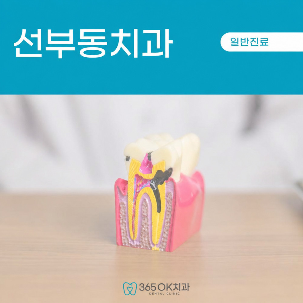 선부동치과 충치치료 방치 시 겉면 변색 이후 치아 내부 진행 핵심 주의사항