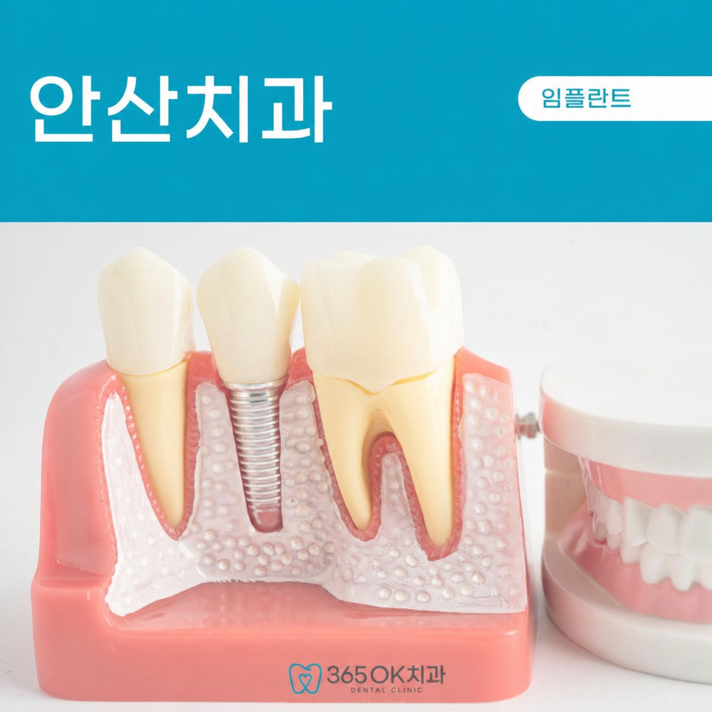 안산치과 임플란트 추천 전 세밀한 진단과 체계적 수술 계획 비교 기준과 치과 선택