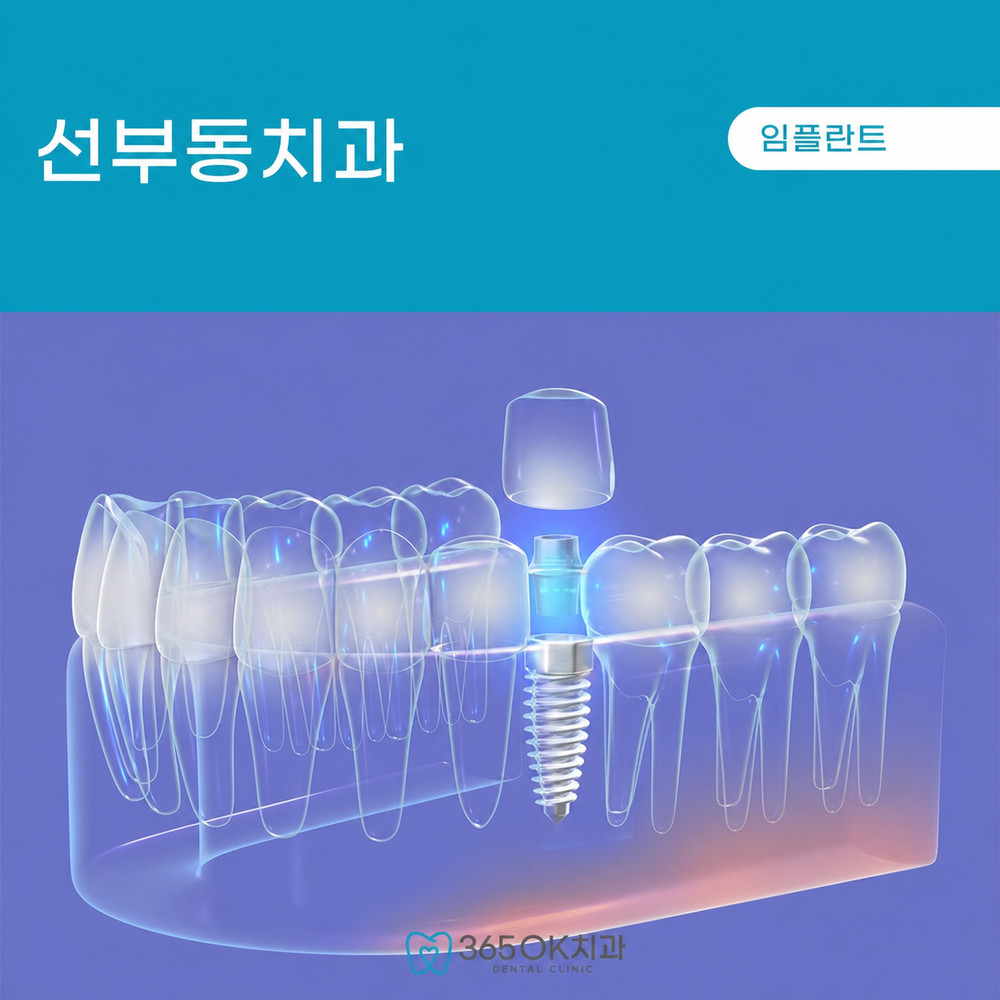 선부동치과 잇몸뼈 부족 임플란트 가능 여부와 치아 방치 후 상담 확인 기준