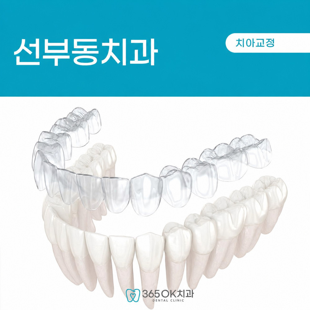 선부동치과 투명교정 선택 전 장치 노출 부담과 사회생활 병행 고민