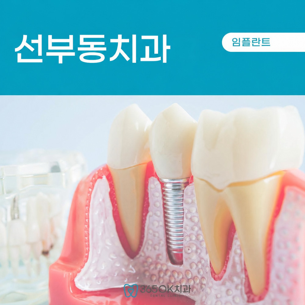 선부동치과 임플란트 발치 후 약한 잇몸 식립 가능 여부 상담 확인 기준