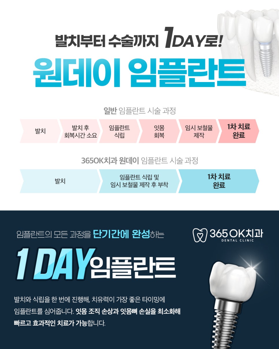 선부동치과 임플란트 구강 구조와 주변 치아 관계 맞춤 식립 계획