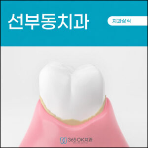 선부동치과-치석-쌓임-이유
