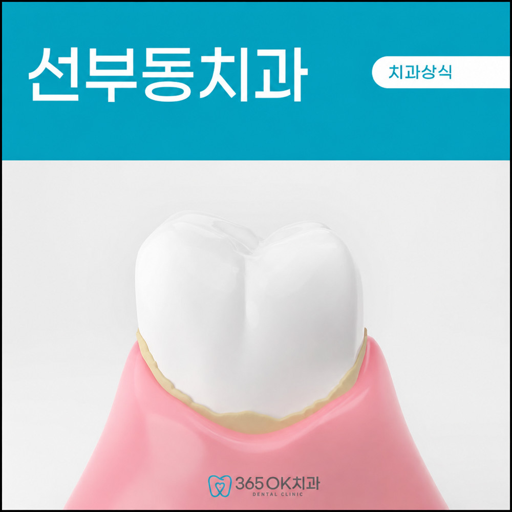 선부동치과에서 안내하는 치태가 굳어 치석이 되는 과정과 사람마다 다르게 쌓이는 이유